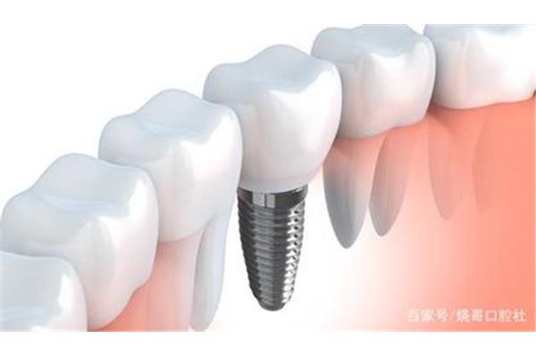 正常牙齒壽命有多久