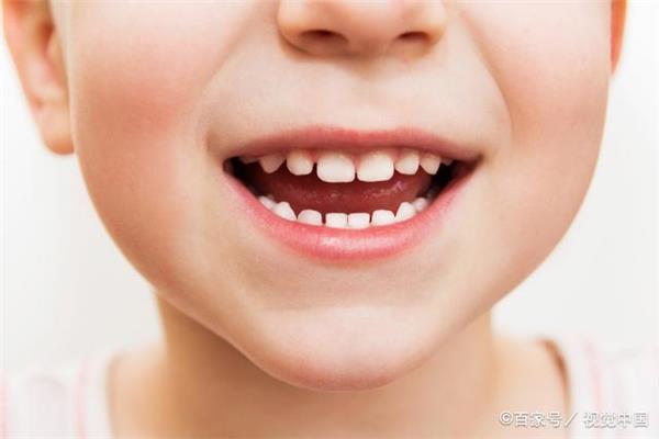 兒童補牙后多久可以吃