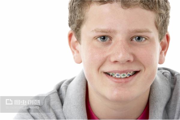 13歲戴牙套多久,13歲做牙齒矯正多久?