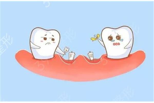 拔牙后多久不出血,拔牙一般多久能恢復?