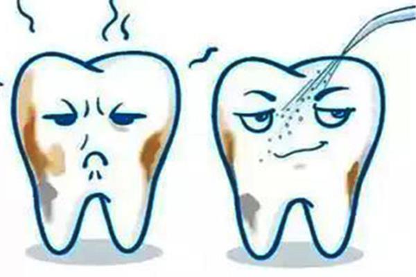 拔牙后多久可以正常吃飯,拔牙后多久可以不痛?