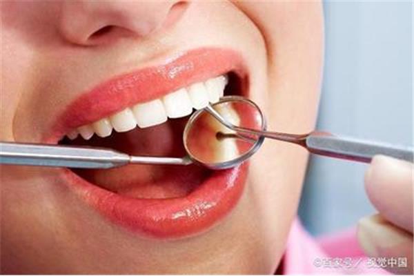 吃補過的牙多久不疼?深齲補牙后需要多長時間適應?