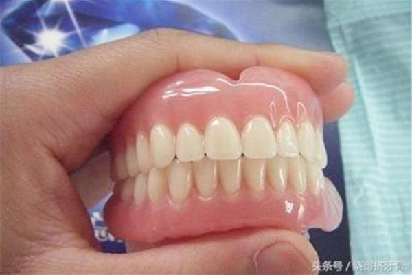 拔過牙多久可以鑲假牙