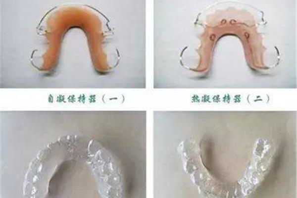 牙齒矯正保持器要戴多久