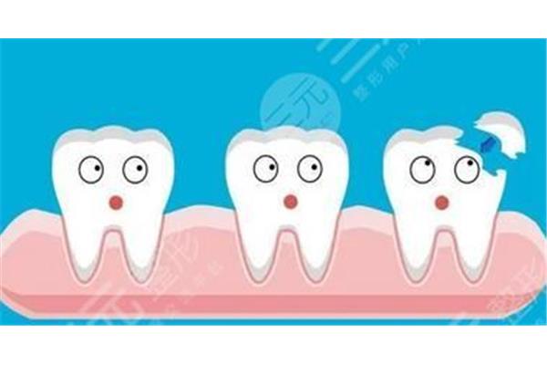 補牙一般可以維持多久