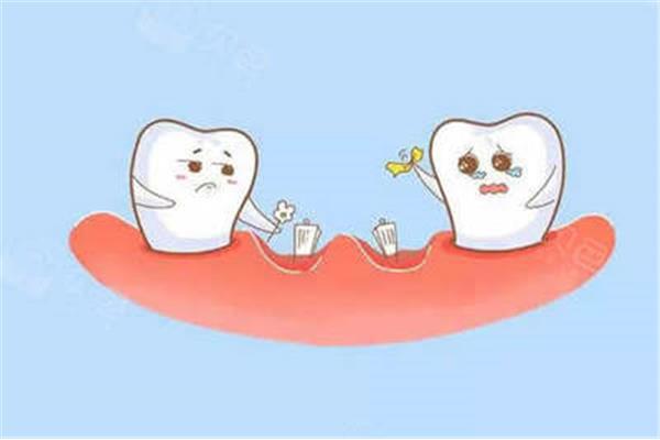 矯正一顆牙齒需要多長時間,矯正一顆脫落的牙齒需要多長時間?