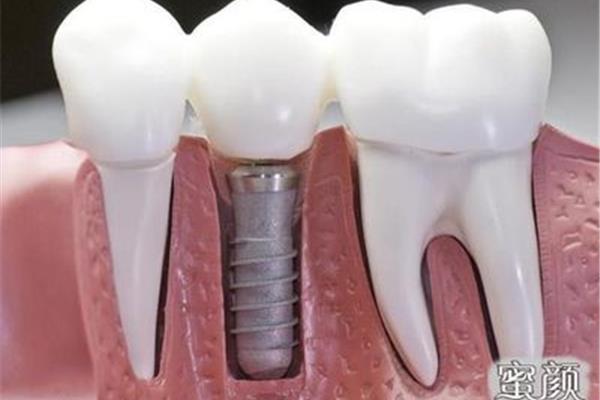 人的牙齒壽命有多久