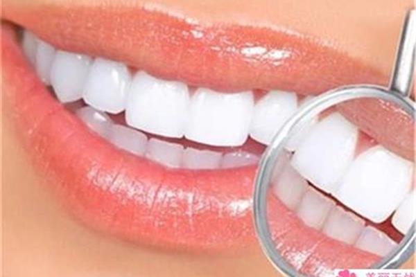 超聲波潔牙能保持多久,噴砂潔牙可以保持多久?