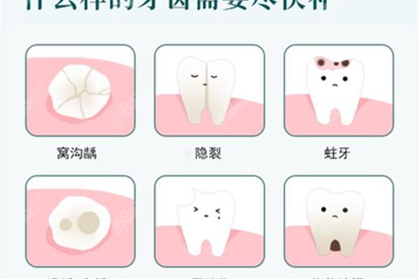 樹脂補牙可以保存多久,對補牙材料過敏會出現多久?