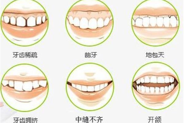 牙齒矯正需要多久,牙套矯正牙齒需要多久?