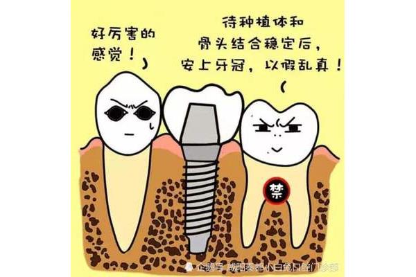 臨時牙可以放多久