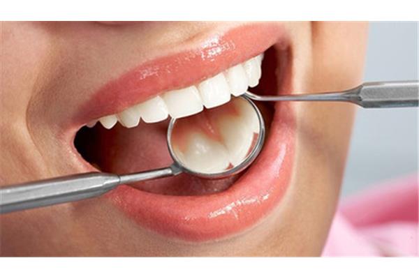 拔牙后多久可以洗牙,拔牙和洗牙的間隔時間應該是多久?