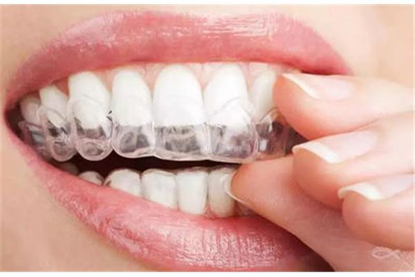 補牙牙套能用多久多久