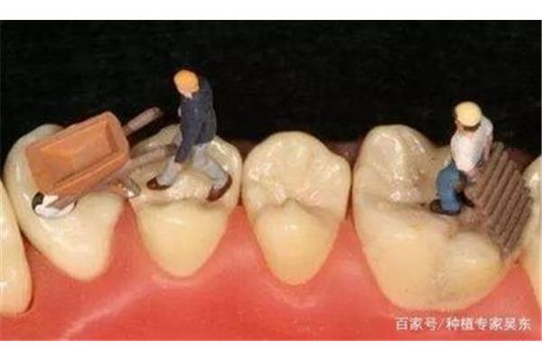 補牙牙齒用多久
