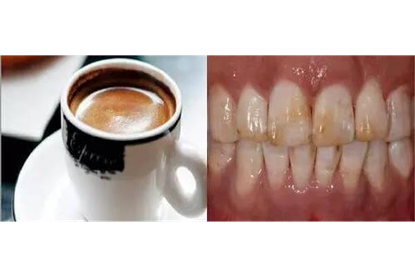 洗牙多久能喝咖啡