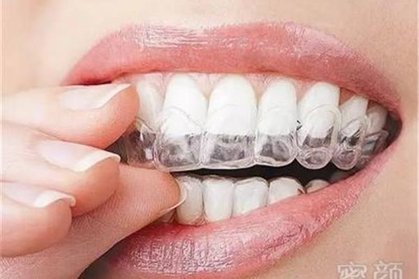 正畸牙模幾天就能做好正畸牙模起什么作用?
