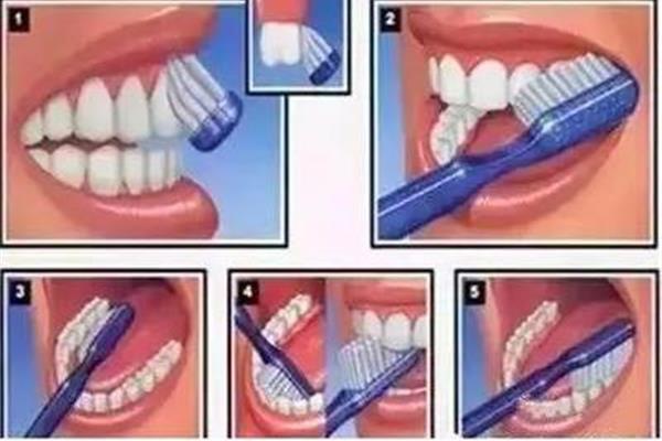 正畸患者刷牙多久