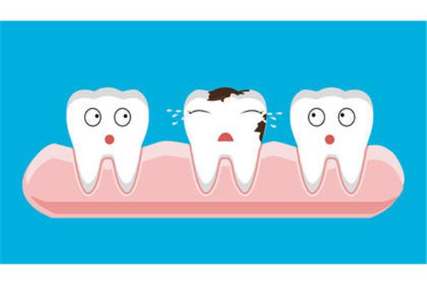 補牙嵌體可以用多久