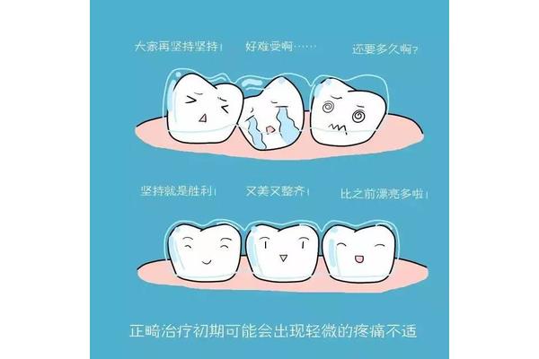 牙齒矯正一般需要多長時間復診,隱形矯正需要多長時間復診?
