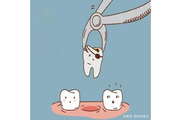 種植牙需要多長時間,裝假牙需要多長時間?