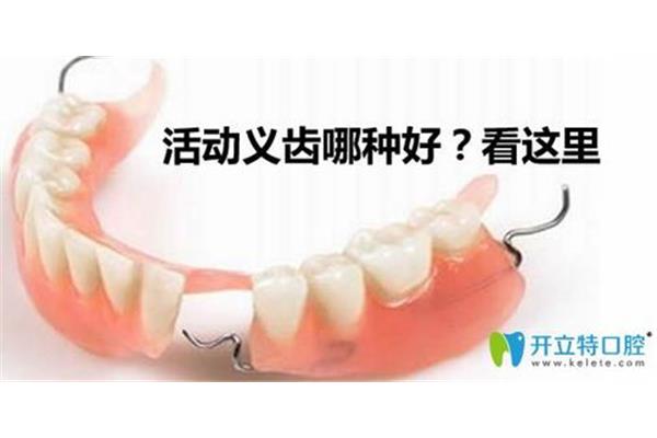 固定假牙能用多久,臨時牙最多能戴多久?