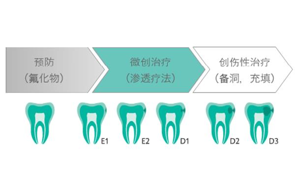 Dmg滲透樹脂能用多久,牙齒滲透樹脂能用多久?