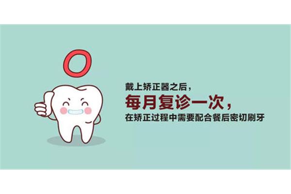 矯正牙齒復診需要多久