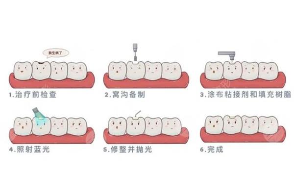 鑲牙能使用多久