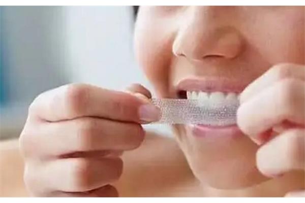 美白牙貼有用嗎? 牙冷光美白能保持多久