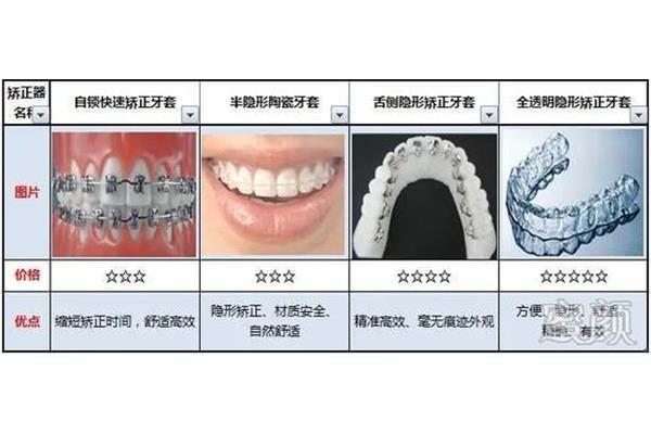戴牙套后多久牙齒會酸痛?用牙套矯正牙齒一般要多少錢?