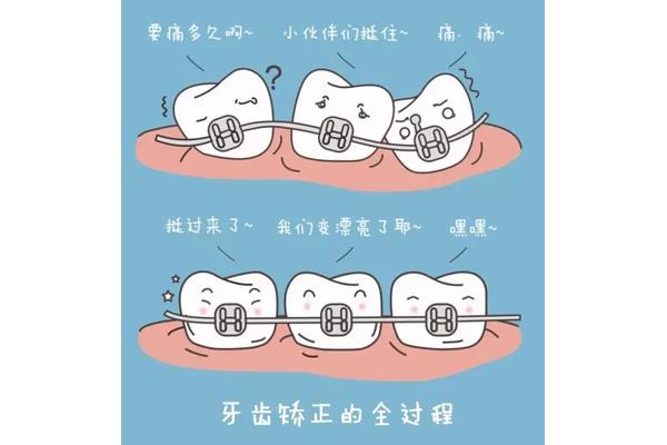 牙齒扭曲的正畸牽引,正畸拔牙后多久能恢復?