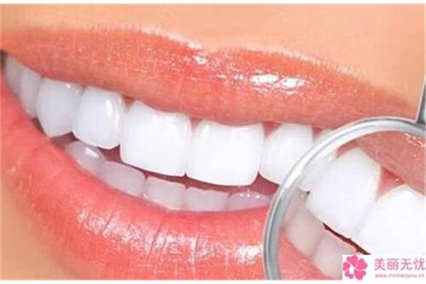牙齒矯正需要戴牙套多長時間?