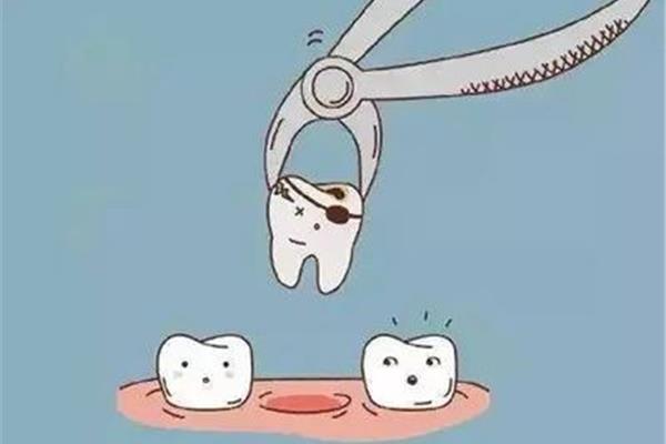 拔牙多久能恢復?一般人不會影響到牙齒