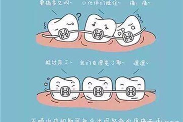 牙齒糾正疼多久