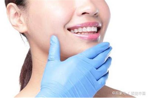 3m補牙使用壽命有多長? 超聲樹脂美容修復