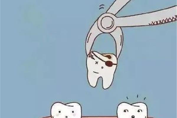 補牙要多長時間?補牙有效期多久