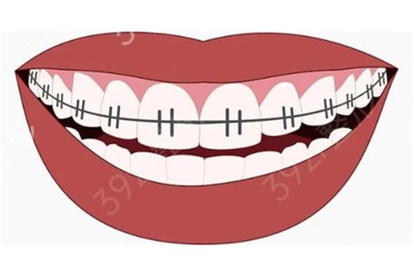 美容冠牙齒能帶多久
