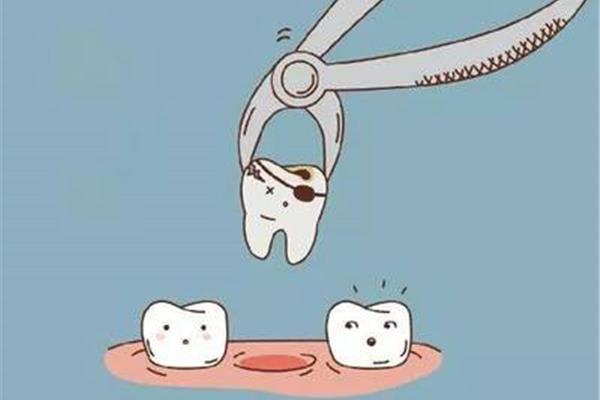 一般多久洗一次牙比較合適 洗牙和拔牙中間要間隔多久