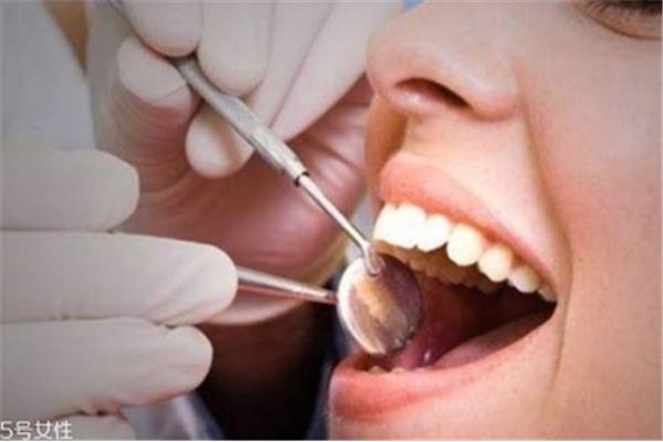 如何正確拔牙和鑲牙? 一般拔牙后多久能潔牙
