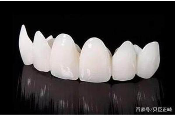 氧化鋯瓷牙能用多久
