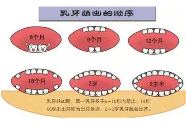 牙齒矯正過程需要多久? 枯牙齒要弄多久