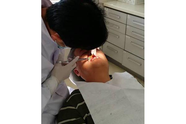 口腔放療和鼻咽癌放療后多久可以拔牙?
