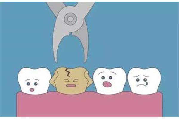 補的牙齒能維持多久