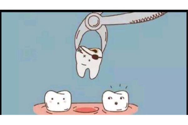 拔牙疼幾天屬于正常 拔智齒后洞多久愈合
