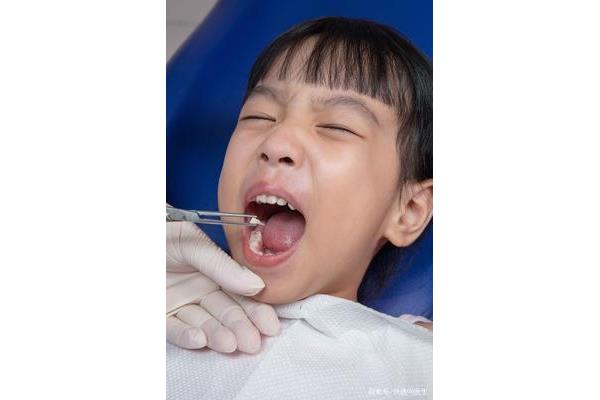 四歲小孩牙疼能拔嗎?孩子拔完牙要多久才能長出來?