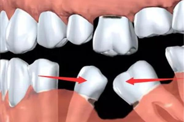 牙周膜多久可以修復