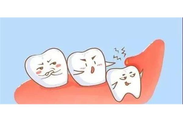 從牙神經穿越到牙套需要多久?