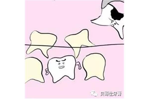 一顆蛀牙需要多長時間脫落,一顆牙齒需要多長時間蛀牙?