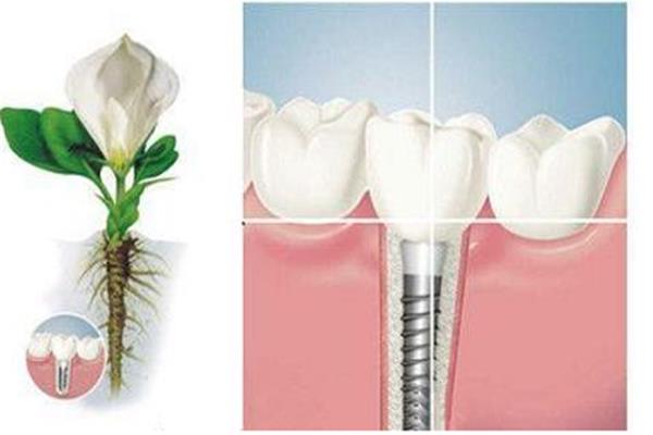 牙齒修復可以管多久