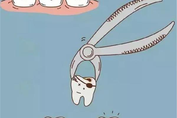 三博口腔牙醫:拔牙要多長時間根據情況而定